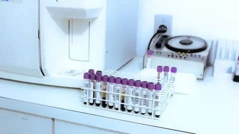 Global HIV Progress Faces Reversal Amid Funding Crisis and Legislative Barriers